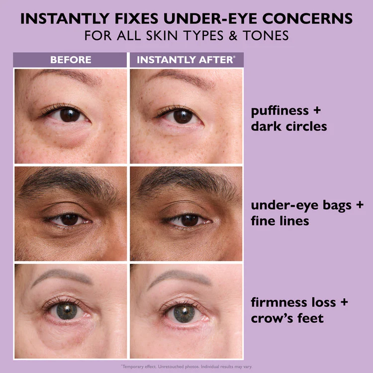 Final 3 Hours: 60%OFF🔥 Instant Eye Tightener Easy-Wear Formula With Brush Free!