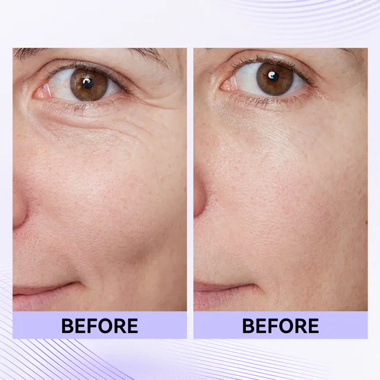Final 3 Hours: 60%OFF🔥 Instant Eye Tightener Easy-Wear Formula With Brush Free!