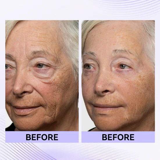 Final 3 Hours: 60%OFF🔥 Instant Eye Tightener Easy-Wear Formula With Brush Free!
