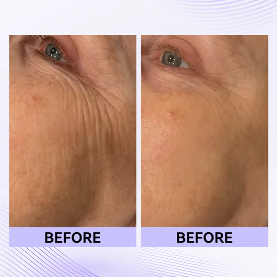 Final 3 Hours: 60%OFF🔥 Instant Eye Tightener Easy-Wear Formula With Brush Free!