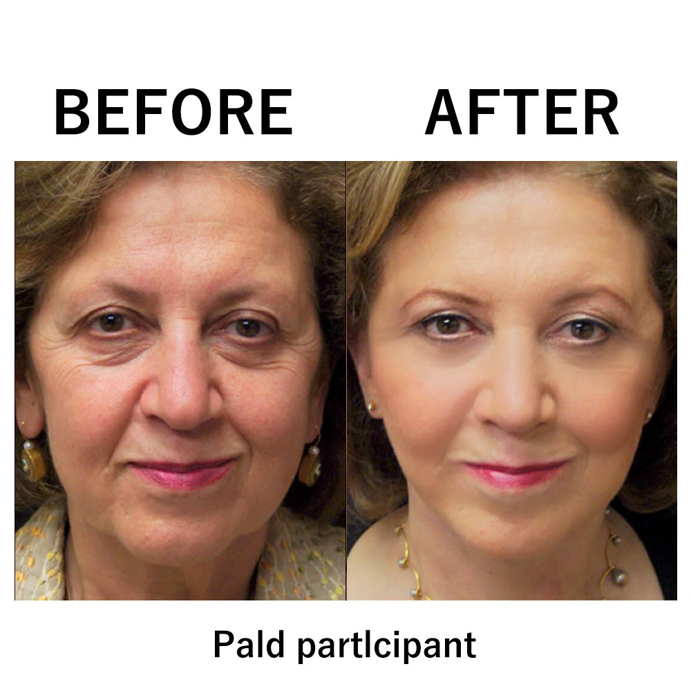 ✨Last Day Discount: 75% OFF lnstant Temporary Face Tightener