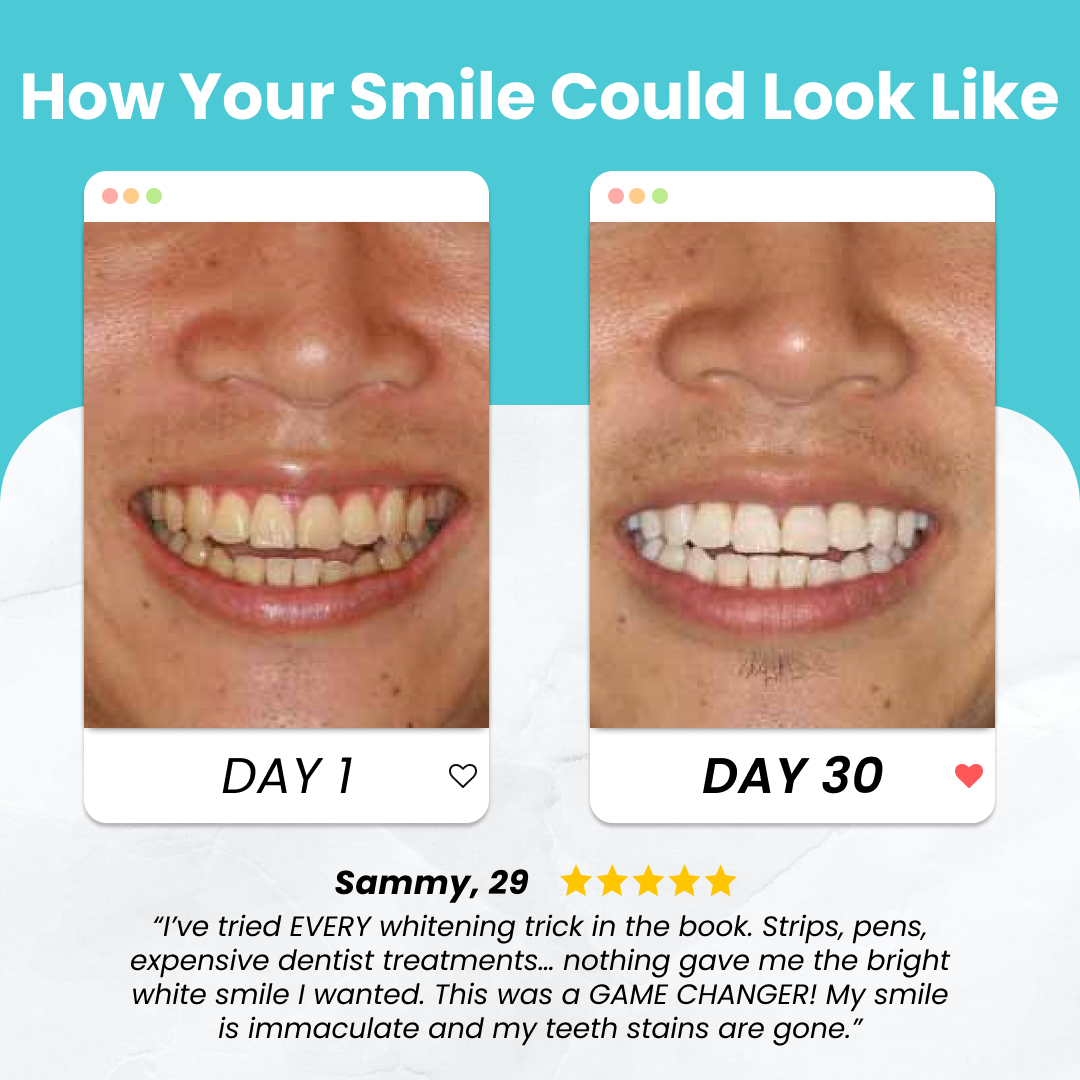 ✨Last Day Discount: 75% OFF 🦷QIAWI™ BRUSH 🦷