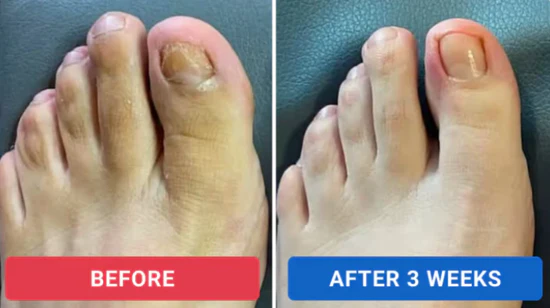 Skavix™ – Nail Repair Patches