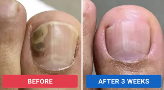 Skavix™ – Nail Repair Patches