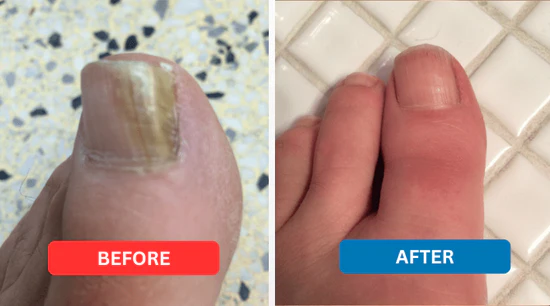 Skavix™ – Nail Repair Patches