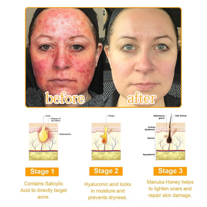 ✅ Official store: LOVILDS™ 7-Day Multi-Effect All-in-One Skincare Cream (AAD Recommended)👨‍⚕️⭐