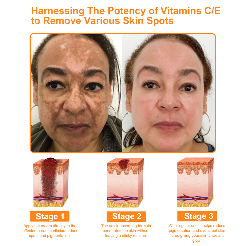 ✅ Official store: LOVILDS™ 7-Day Multi-Effect All-in-One Skincare Cream (AAD Recommended)👨‍⚕️⭐