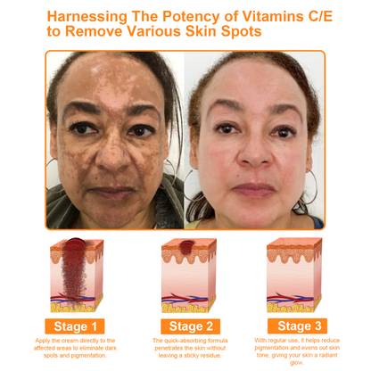 ✅ Official store: LOVILDS™ 7-Day Multi-Effect All-in-One Skincare Cream (AAD Recommended)👨‍⚕️⭐