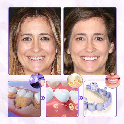 BBOJI® BeeRenew Advanced Gum Healing Toothpaste