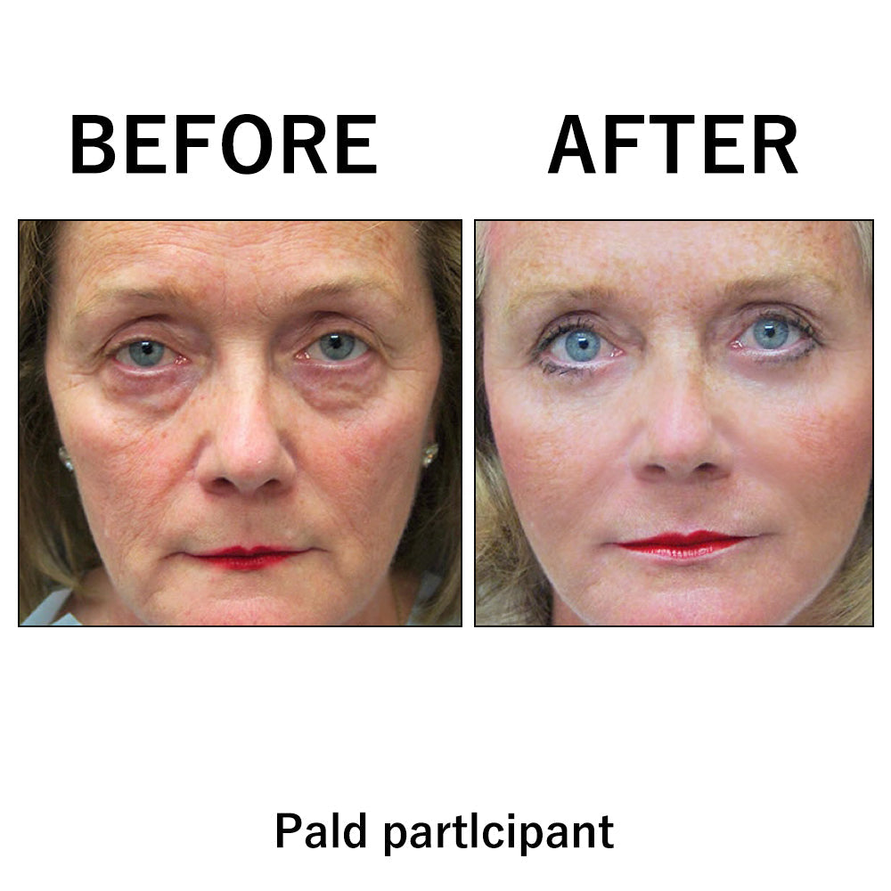 ✨Last Day Discount: 75% OFF lnstant Temporary Face Tightener
