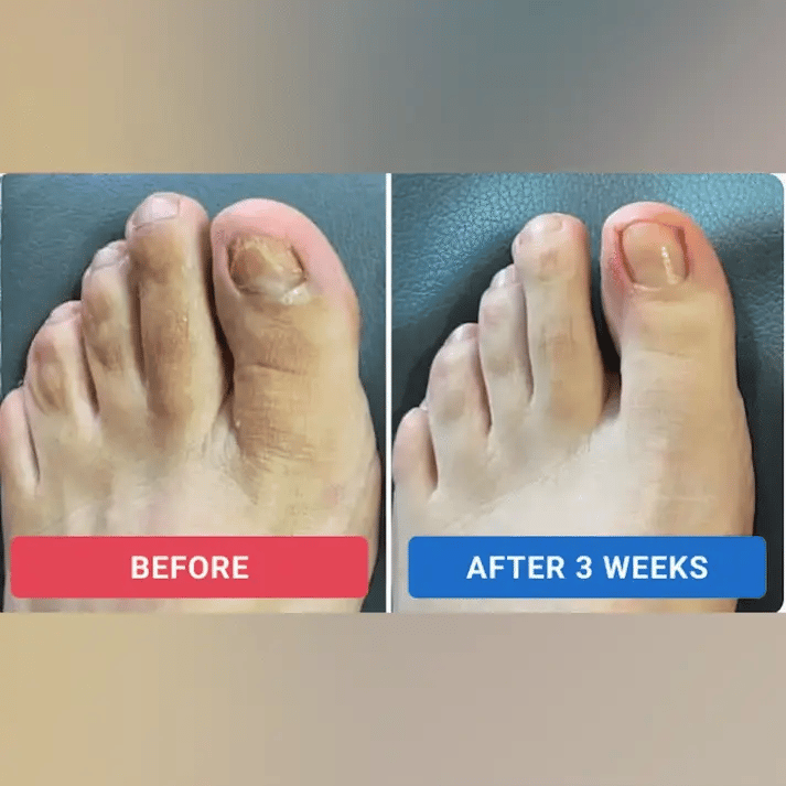 Skavix™ – Nail Repair Patches