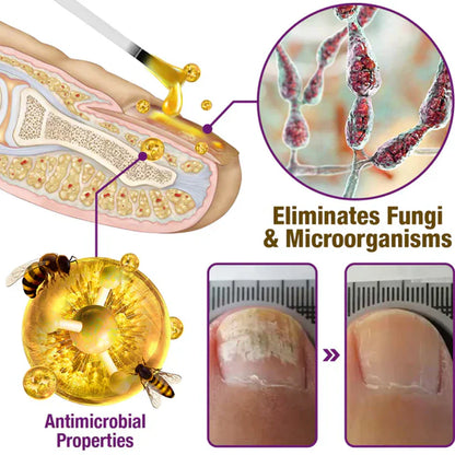 🐝BBOJI™ Fungus-Fres Bee poison  Nail Treatment Serum